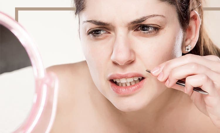 Hirsutism