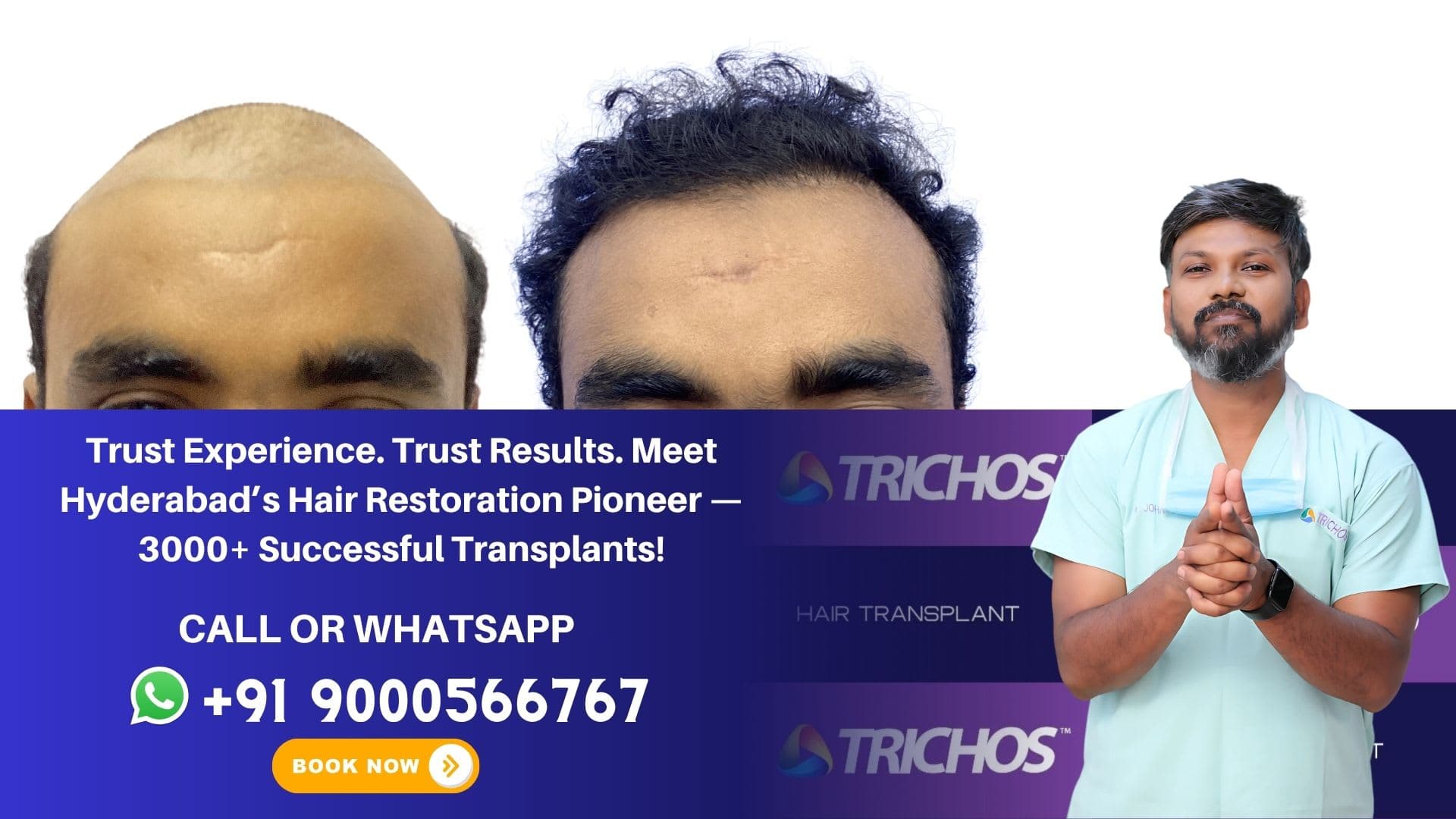 Dr. John Watts, leading hair transplant surgeon in Hyderabad, specializing in FUE, Long Hair Transplant and SMP