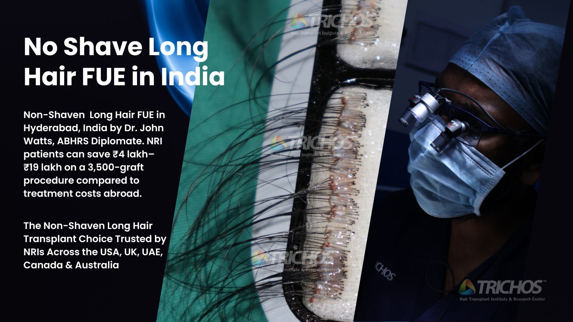 Advanced Long Hair FUE in Hyderabad with Internationally Recognized Expertise