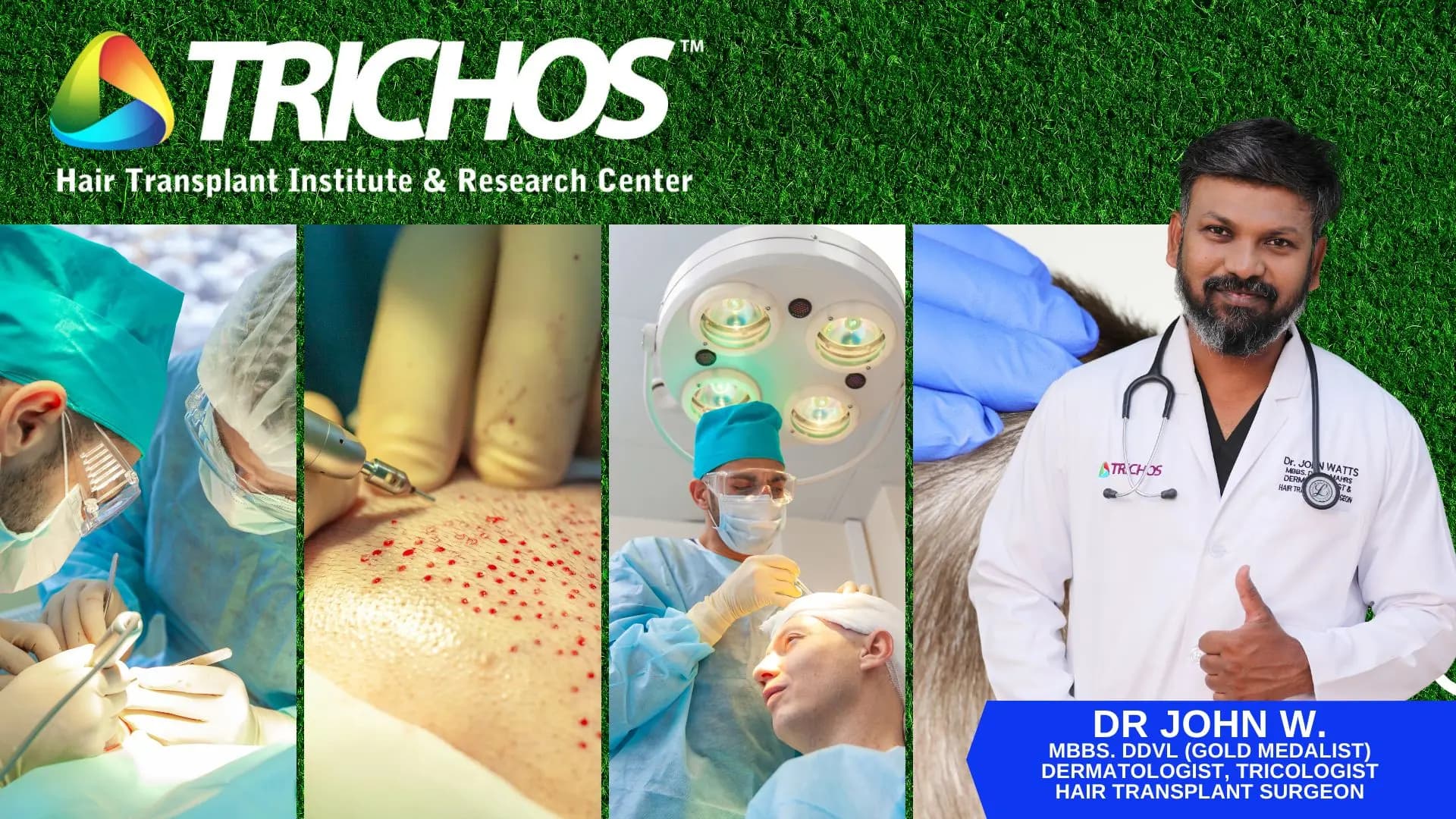 Best Hair Transplant Center in Hyderabad
