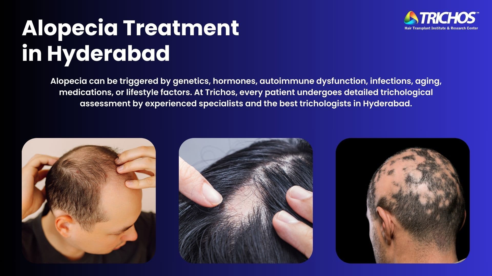 Educational graphic showing genetic, autoimmune, and lifestyle-related alopecia types with examples of scalp hair loss for hair loss treatment at Trichos