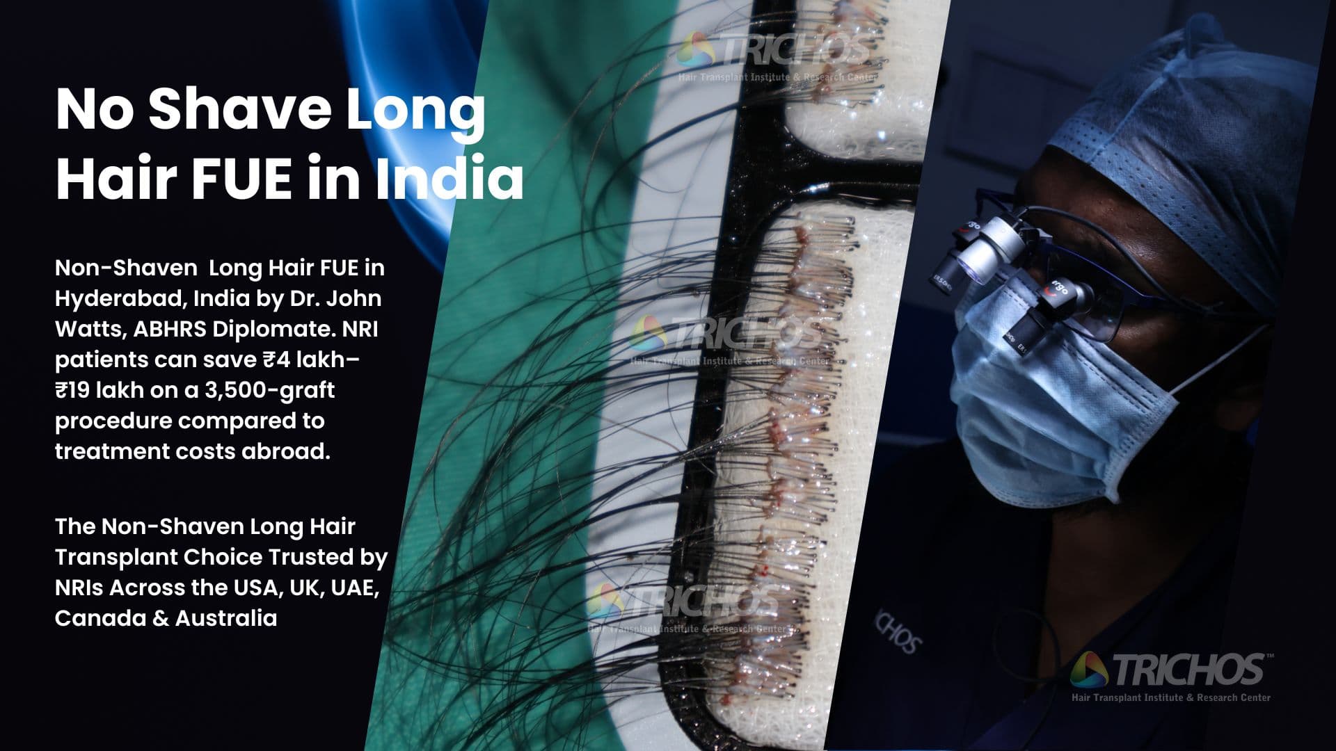 Advanced Long Hair FUE in Hyderabad with Internationally Recognized Expertise
